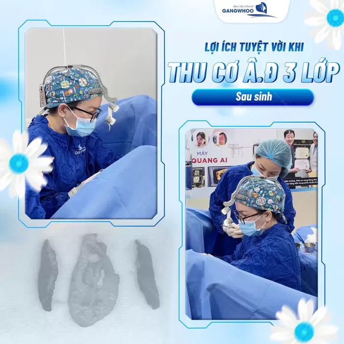 Thu Cơ Âm Đạo: "Cô Bé E Ấp" Cho Chàng Thăng Hoa 1 Thu cơ âm đạo 3 lớp sau sinh giải pháp hoàn hảo để hồi xuân cô bé một cách an toàn và hiệu quả