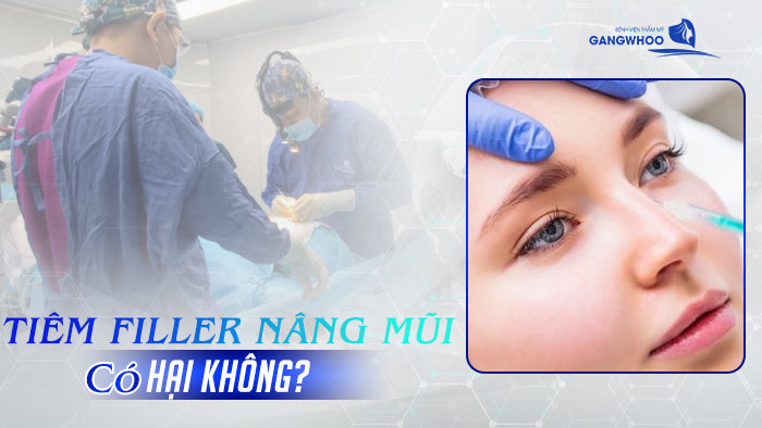 Tiêm Filler Nâng Mũi Có Hại Không? Hướng Dẫn Chăm Sóc An Toàn 6 Tiêm Filler Nâng Mũi Có Hại Không