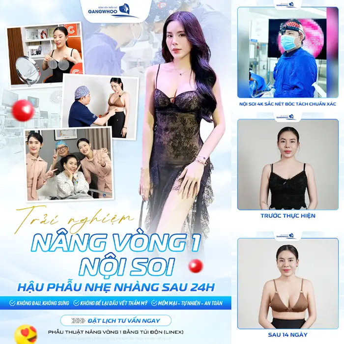 Phẫu Thuật Nội Soi Nâng Ngực (Nâng Ngực Ergonomix) - Ngực Đẹp Mềm Mại Thêm Căng Tròn 5 Trải nghiệm nâng vòng 1 nội soi vòng 1 căng đẹp và thu hút ánh nhìn sau 14 ngày thực hiện