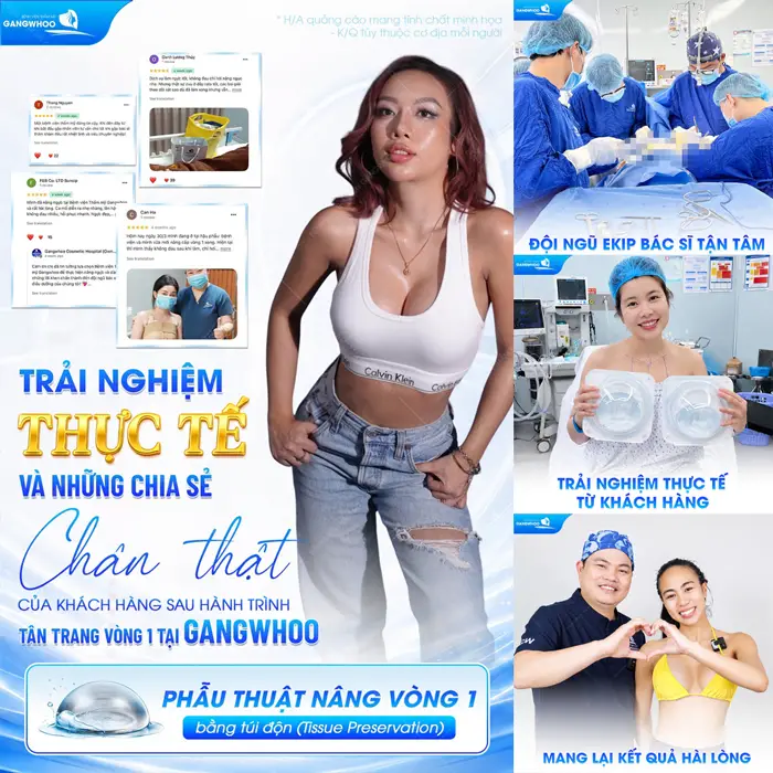 Khách hàng nâng cấp vòng 1 tại Gangwhoo chia sẻ trải nghiệm làm đẹp hài lòng với sự tận tâm - chuyên nghiệp 