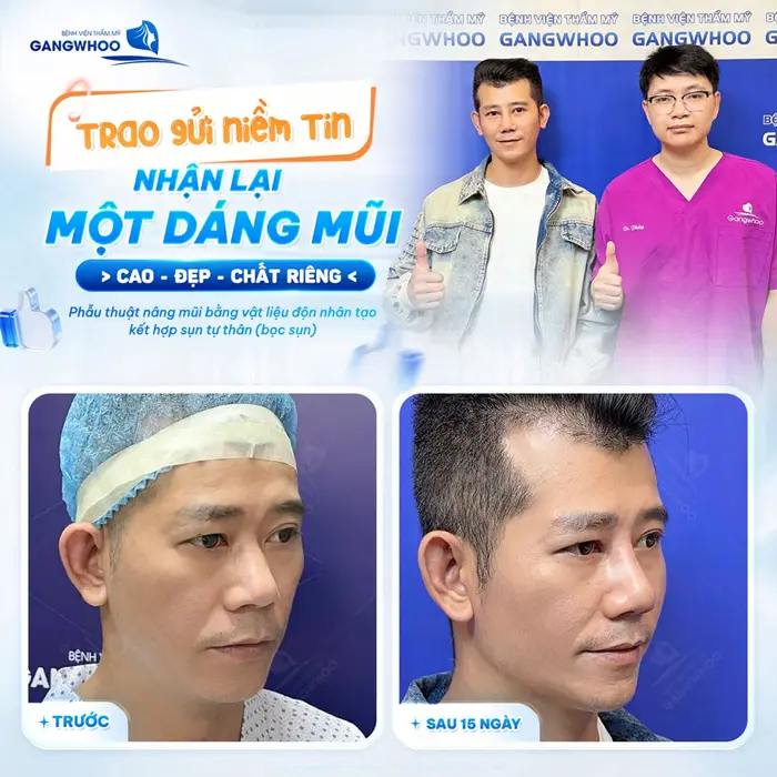 Trao gửi niềm tin đúng nơi nhận lại kết quả đúng ý nhan sắc đầy phong độ sau can thiệp phẫu thuật