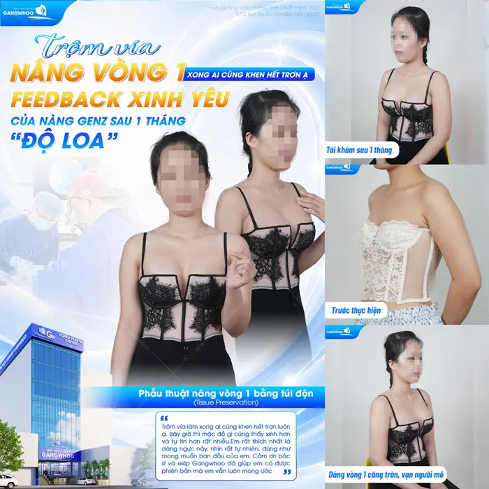 Nâng Ngực Qua Đường Quầng Vú Là Gì? Đối Tượng Nên Thực Hiện? 1 Nâng vòng 1 tôn đường cong quyến rũ cho vóc dáng, nàng GenZ feedback cực xịn sau 1 tháng thực hiện
