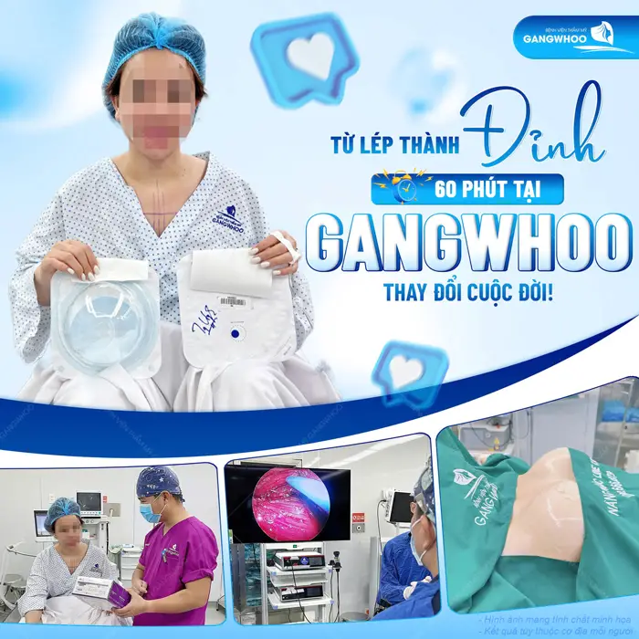 Từ lép thành đỉnh chỉ sau 60 phút phẫu thuật nâng cấp vòng 1 tại BVTM Gangwhoo