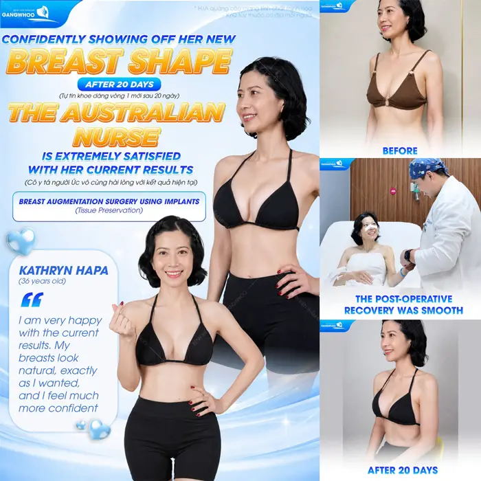 Nâng Ngực Qua Đường Rốn Là Gì? Có An Toàn Không? 2 Tự tin hơn với body đẹp quyến rũ sau 20 ngày tái khám đã tự tin chạm đường cong quyến rũ