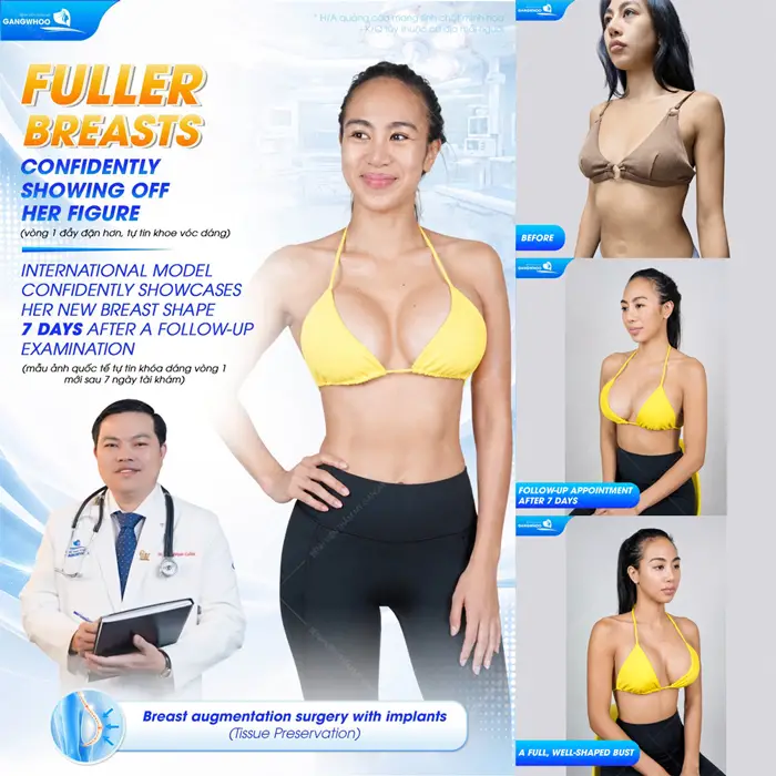 Nâng cấp vòng 1 sau 7 ngày body đẹp thăng hạng đầy rạng rỡ và cuốn hút với sắc vóc thêm quyến rũ