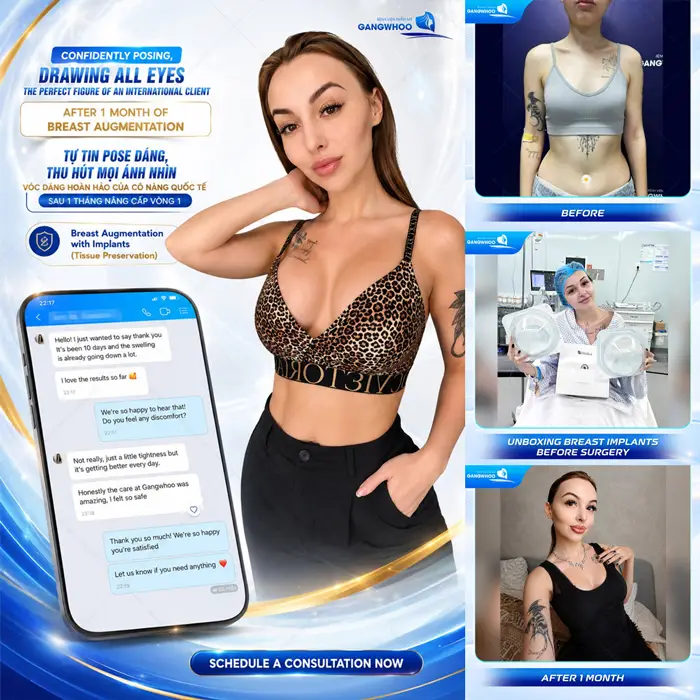 Nâng Ngực Bao Lâu Thì Lành? Cách Chăm Sóc Để Ngực Nhanh Lành 5 Tự tin pose dáng đẹp xuất sắc tôn đường cong cho body đẹp hoàn hảo và thêm thăng hạng