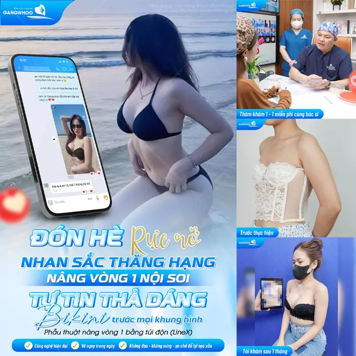 Đón hè rực rỡ nhan sắc thăng hạng với kết quả nâng vòng 1 nội soi tự tin thả dáng diện bikini cực kỳ xinh đẹp