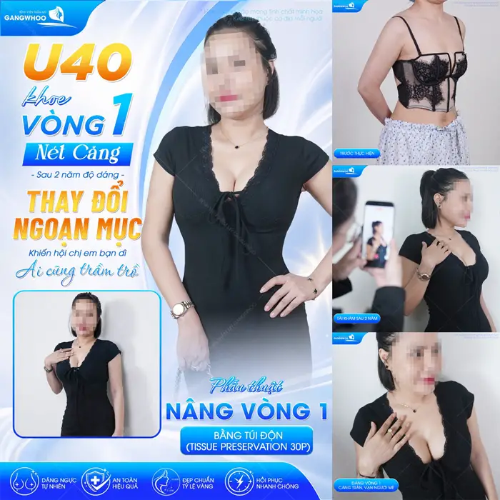 U40 khoe vòng 1 nét căng sau 2 năm độ dáng thay đổi ngoạn mục khiến hội chị em phải trầm trồ