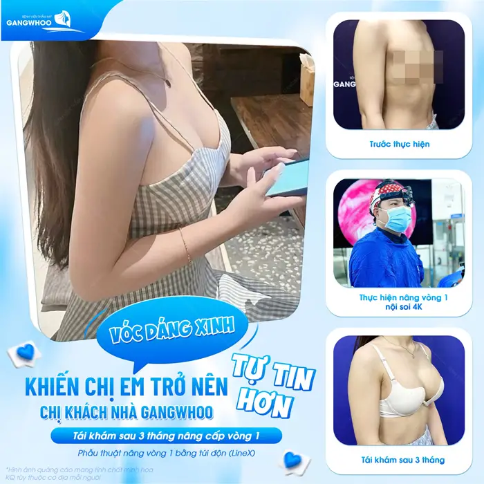 Vóc dáng xinh vòng 1 đẹp cuốn hút tôn sắc vóc đẹp hoàn hảo sau 3 tháng tái khám đã đẹp hấp dẫn ánh nhìn