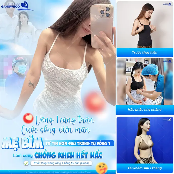 Vòng 1 căng tràn cuộc sống viên mãn của mẹ bỉm sau trùng tu vòng 1 được chồng khen hết nấc