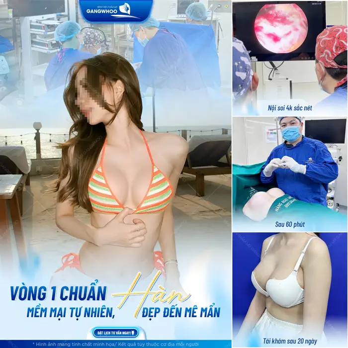 Vòng 1 chuẩn Hàn mềm mại, tự nhiên đẹp đến mê mẩn sau 20 ngày thực hiện