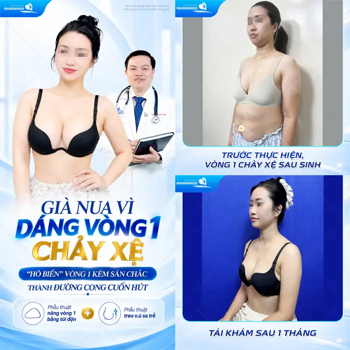 Nâng cấp vòng 1 chảy xệ hô biến "vòng 1" kém săn chắc thành đường cong cuốn hút sau 1 tháng thực hiện