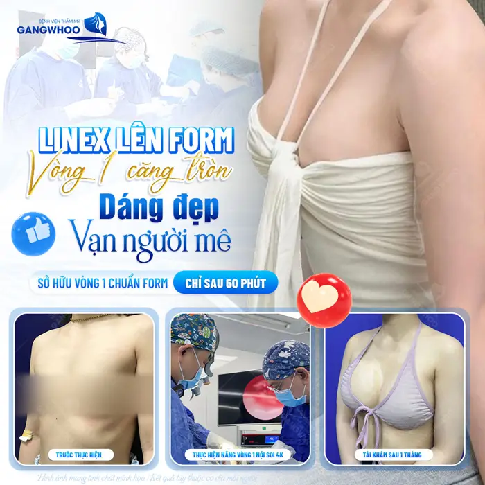 Nâng Ngực Line X – Vòng 1 Gợi Cảm Chuẩn Tỉ Lệ Vàng 4 Nâng vòng 1 LineX đẹp chẩun form dáng nuột vạn người mê