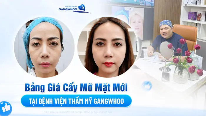 bang gia cay mo mat
