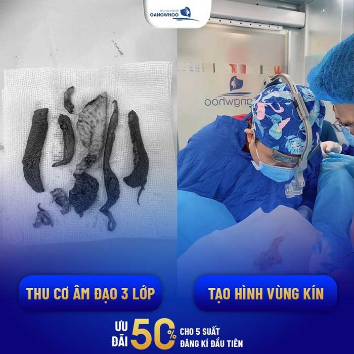 Bảng Giá Thẩm Mỹ Vùng Kín, Bộ Phận Sinh Dục, Âm Đạo 6 Bảng Giá Thu Nhỏ Vùng Kín, Thẩm Mỹ Âm Đạo