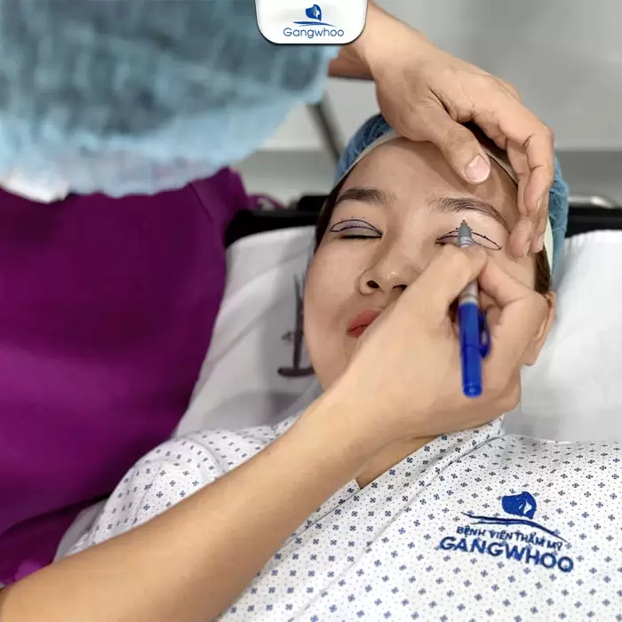 chinh sup mi bam sinh en 2