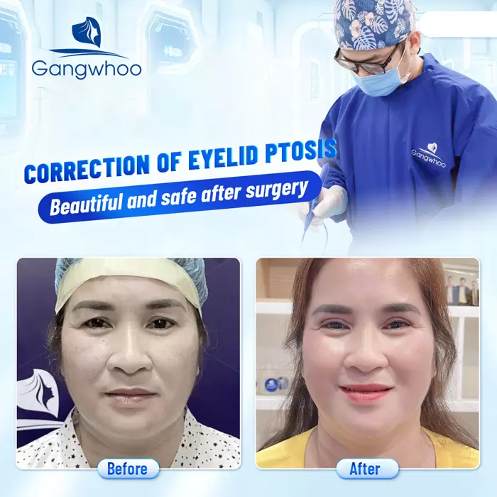 chinh sup mi bam sinh en 3