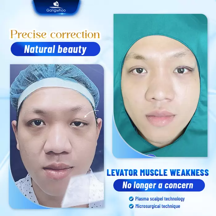 chinh sup mi bam sinh en 5