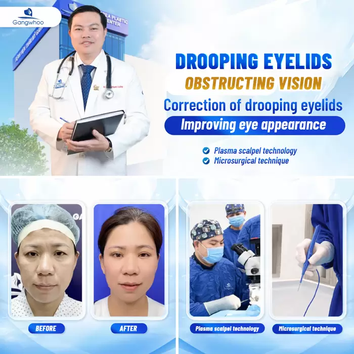 chinh sup mi bam sinh en 7