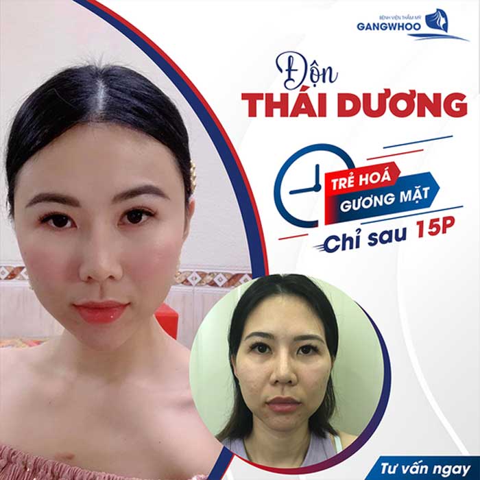 don thai duong 4