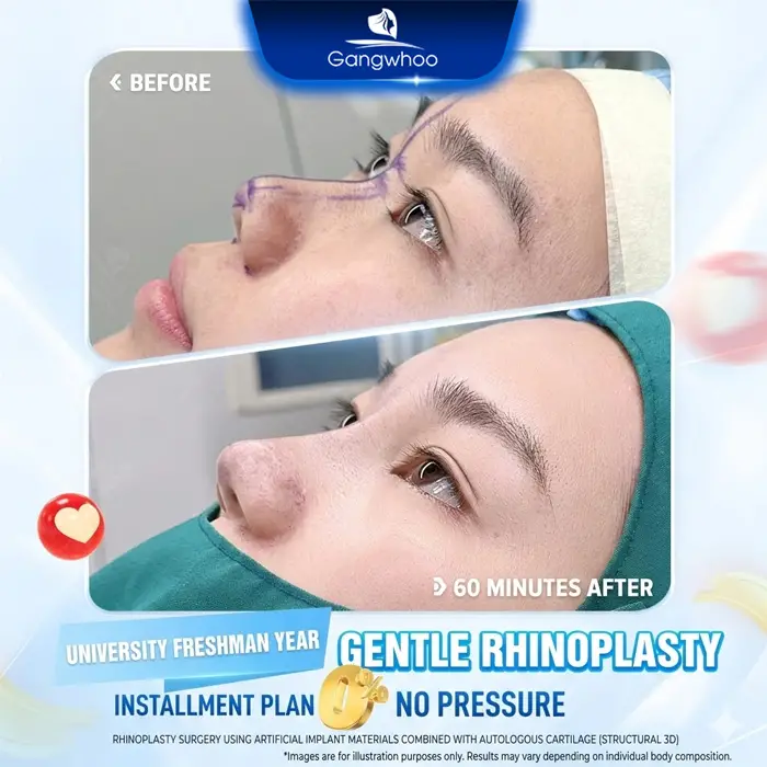 en bi seo loi co nang mui duoc khong 4