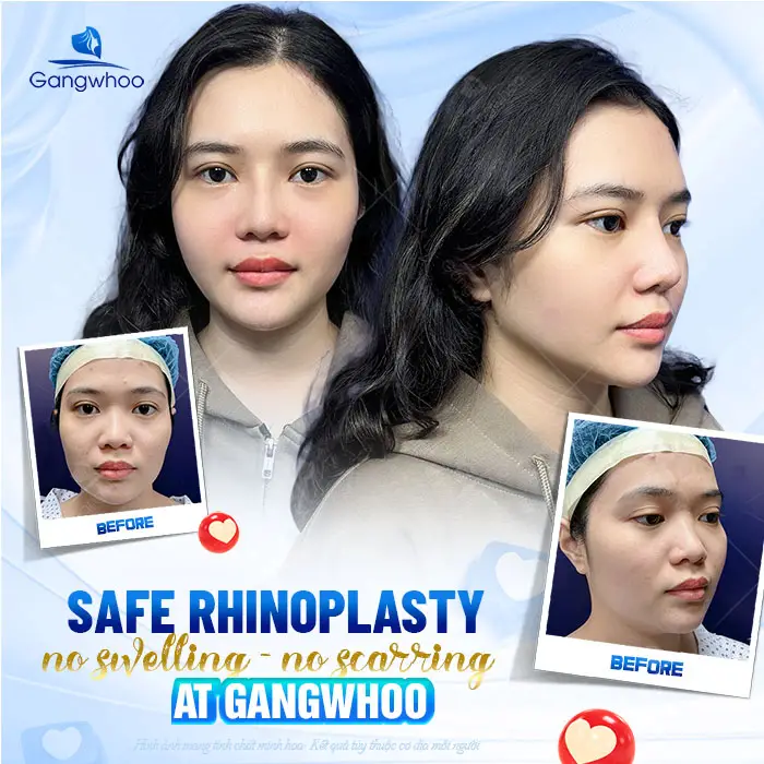 en co dia seo loi nang mui duoc khong 1