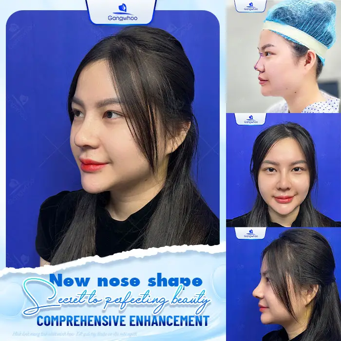 en co dia seo loi nang mui duoc khong 2