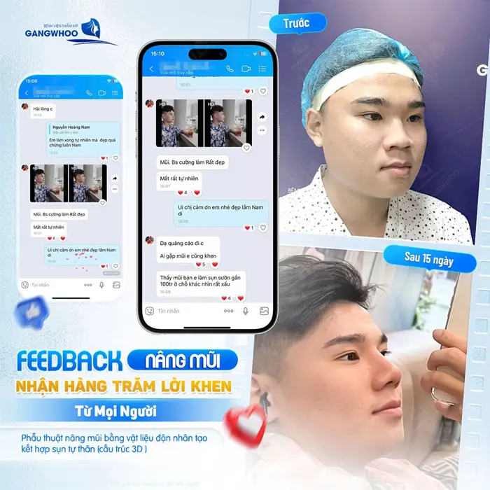 Feedback nâng mũi nhân hàng trăm lời khen từ mọi người 