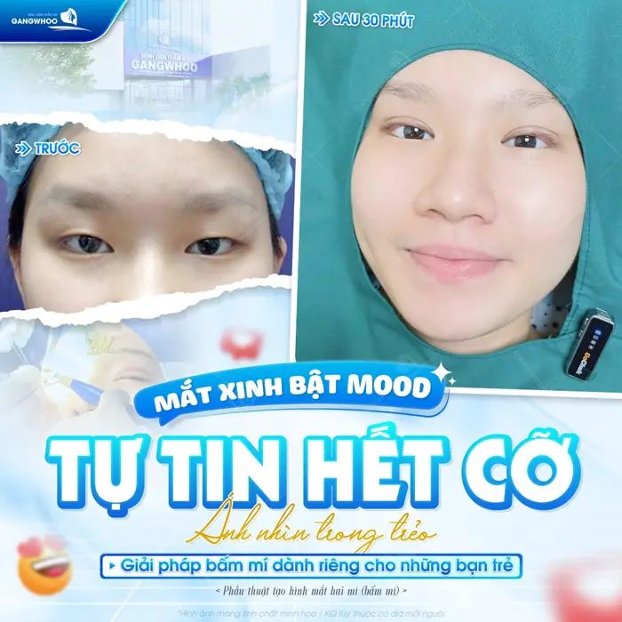 Mắt xinh bật mood tự tin hết cỡ ánh nhìn trong trẻo giải phápcho diện mạo trẻ đẹp