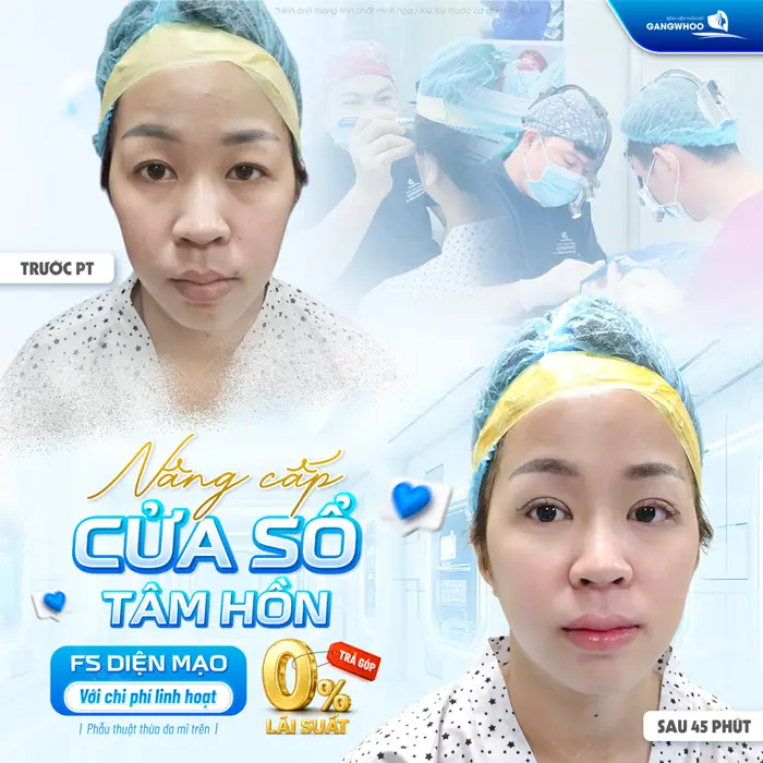Nâng cấp cửa sổ tâm hồn F5 diện mạo với chi phí cực hời, cực yêu