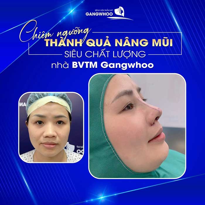 nang mui bang chi 1 1