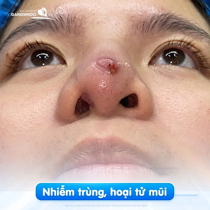 nang mui bang chi co tot khong 1