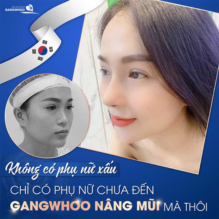 nang mui gangwhoo 5