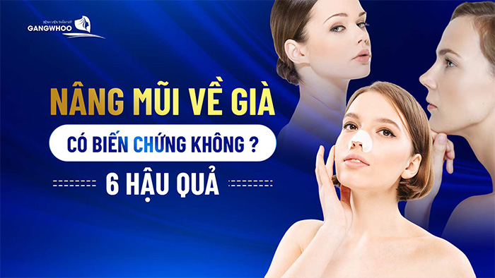 nang mui ve gia co bien chung khong 3