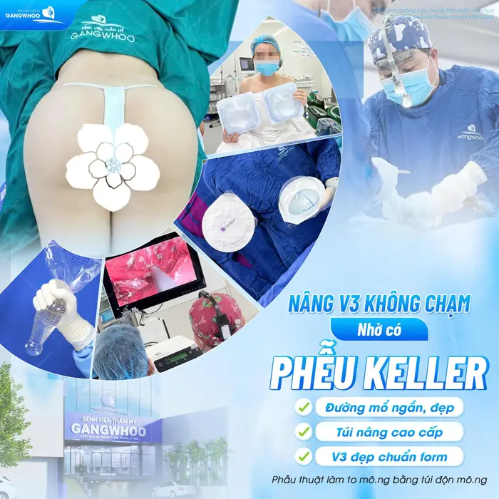 Dịch vụ nâng mông trả góp - Không lo về giá 4 Nâng mông không chạm nhờ có công nghệ hiện đại yên tâm nhận kết quả mãn nhãn với mơ ước của nhiều chị em phụ nữ