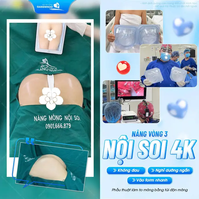 Dịch vụ nâng mông trả góp - Không lo về giá 2 Nâng vòng 3 nội soi 4K không đau nghỉ dưỡng ngắn vào form đẹp nhanh chóng