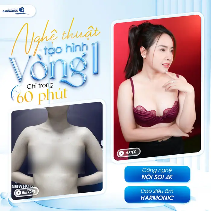 Nâng Ngực Nội Soi Túi Nano Chip Công Nghệ Harmonic Hàn Quốc 6 nghe thuat tao hinh vong 1 dep cho khach hang