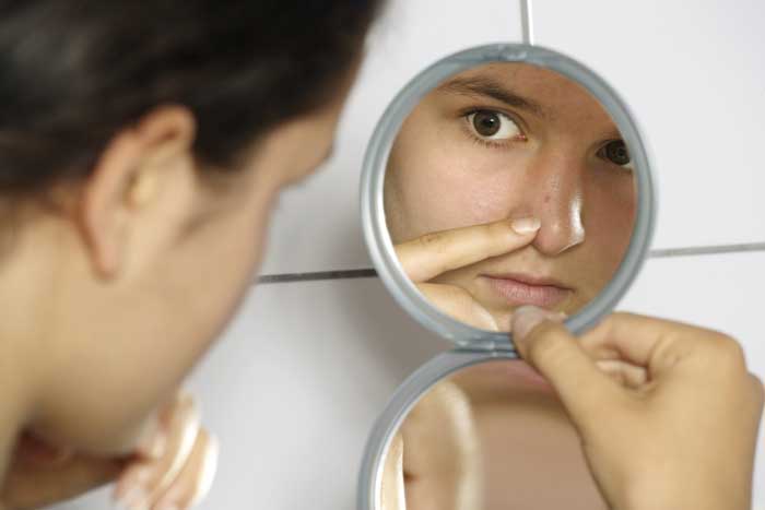 Should you have blackhead & acne removal after rhinoplasty or not?