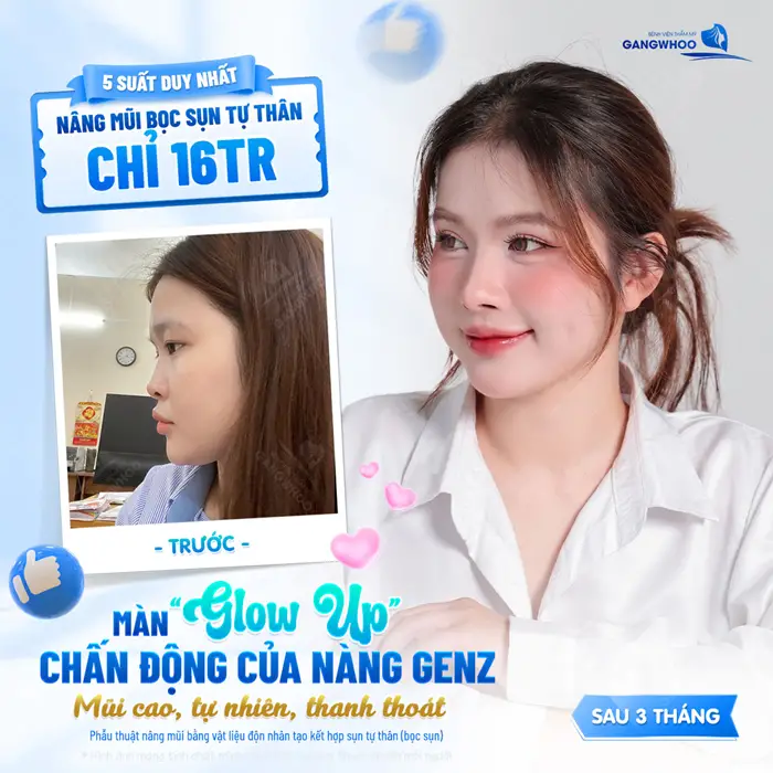 Dịch vụ thẩm mỹ trả góp có tốt không? 2 Nhan sắc đẹp chấn động với chi phí siêu ưu đãi mũi cao đẹp, tự nhiên và thanh thoát cuốn hút