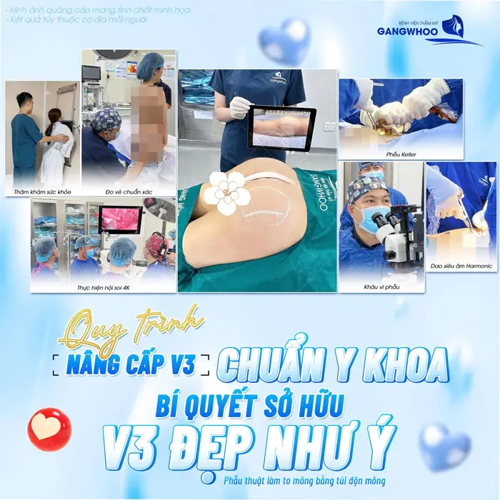 Dịch vụ nâng mông trả góp - Không lo về giá 1 Quy trình nâng cấp vòng 3 chuẩn y khoa bí quyết sở hữu vòng 3 đẹp chuẩn như ý