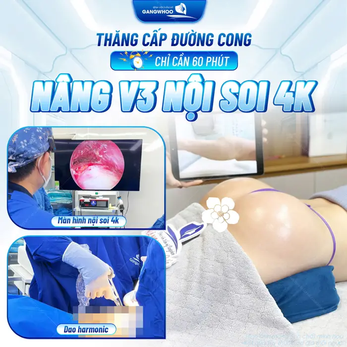 Dịch vụ nâng mông trả góp - Không lo về giá 5 Thăng cấp đường cong chỉ cần 60 phút nâng vòng 3 nội soi 4K đường cong đã chạm đỉnh thu hút