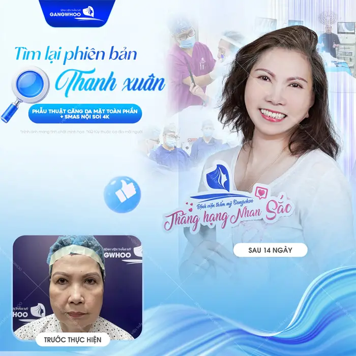 Tìm lại phiên bản thanh xuân trẻ đẹp đến bất ngờ sau 14 ngày căng da mặt với làn da đẹp hơn, trẻ trung hơn