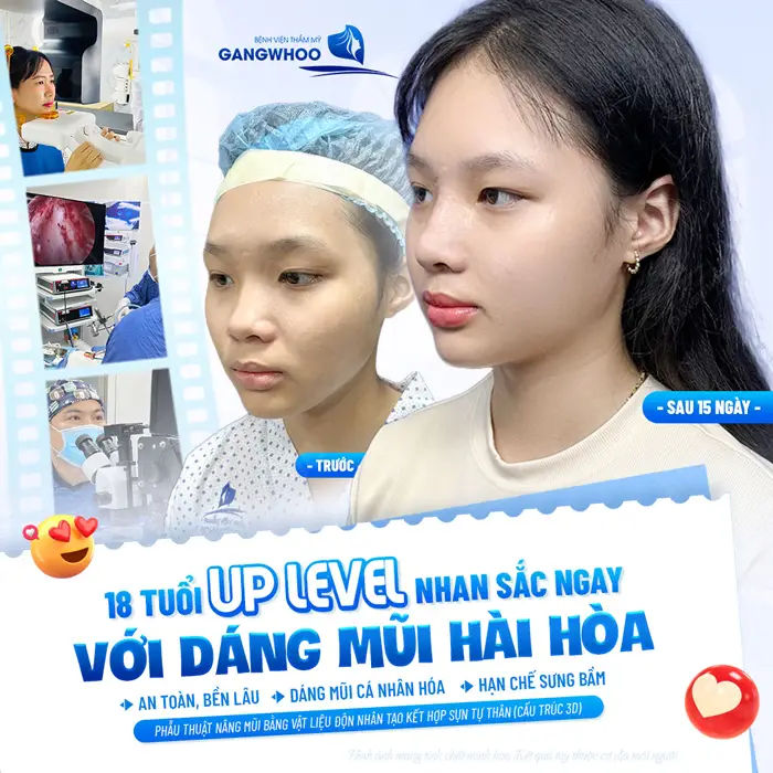 18 tuổi nhan sắc đẹp sang tự tin với diện mạo mới đầy thăng hạng và hài hòa tự nhiên
