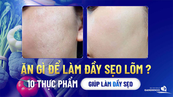 an gi lam day seo lom
