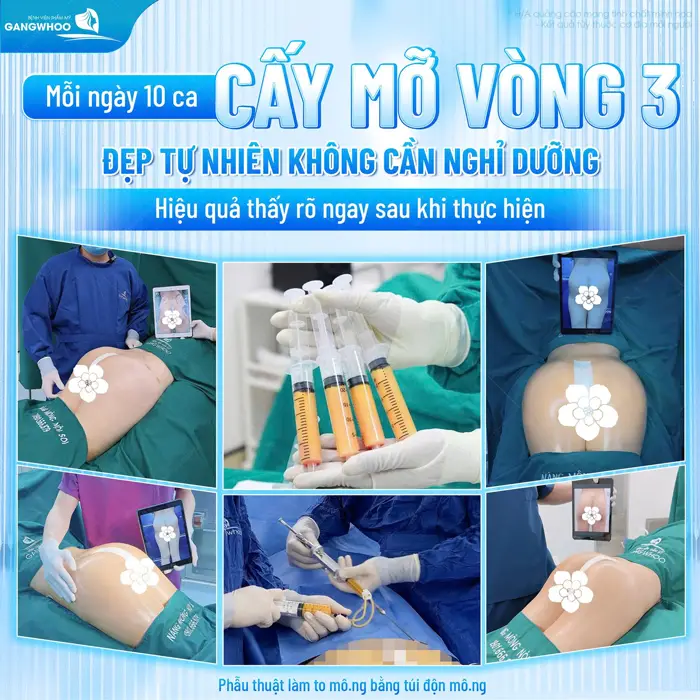 Top 10 Bác Sĩ Nâng Mông Giỏi Tại TPHCM Được Nhiều Khách Hàng Chọn