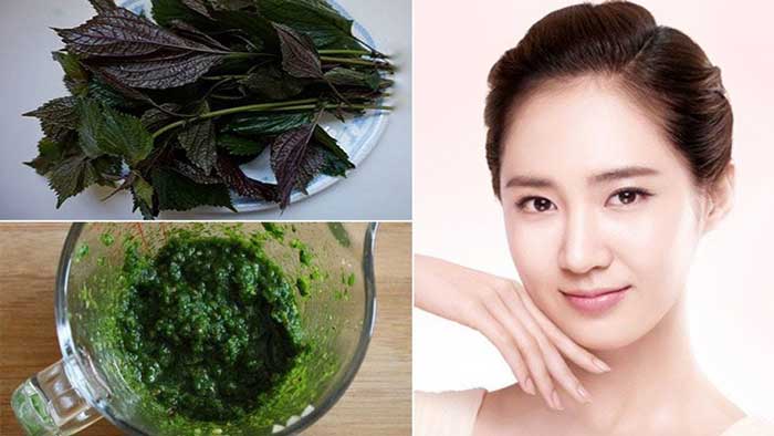 Effective acne treatment with perilla leaves