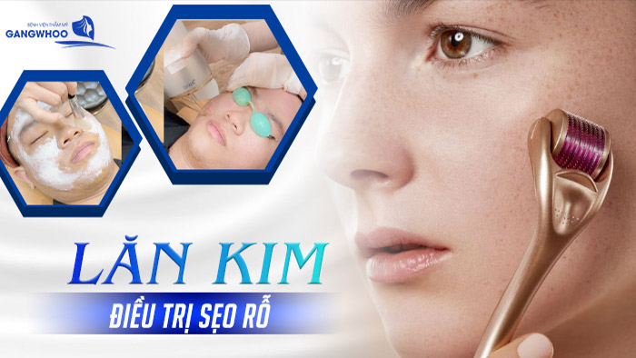 lan kim