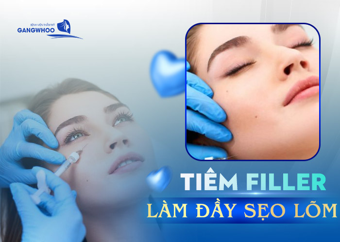 Tiêm Chất Làm Đầy Sẹo Lõm Thực Chất Có Hiệu Quả Không? 6 Tiêm Chất Làm Đầy Sẹo Lõm