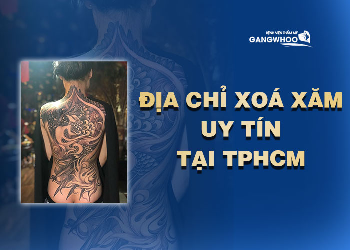 Cosmetic facilities for tattoo removal in HCM City
