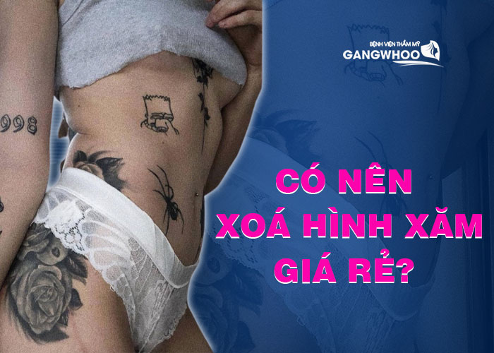 Should we use cheap tattoo removal services?